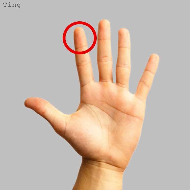 中指长痣代表什么_中指背面长痣代表什么_男戴中指戒指代表什么