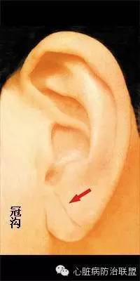 耳垂反复长疙瘩_耳垂长疙瘩怎么办_耳垂背面长痣
