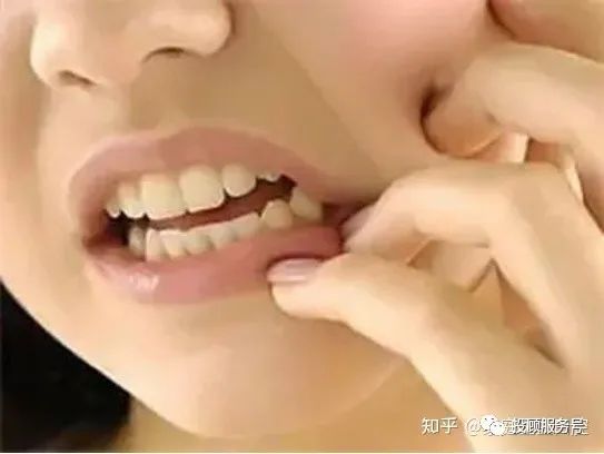 牙齿深覆合的面相_牙齿深覆合矫正后脸型_牙齿深覆合矫正前后对比