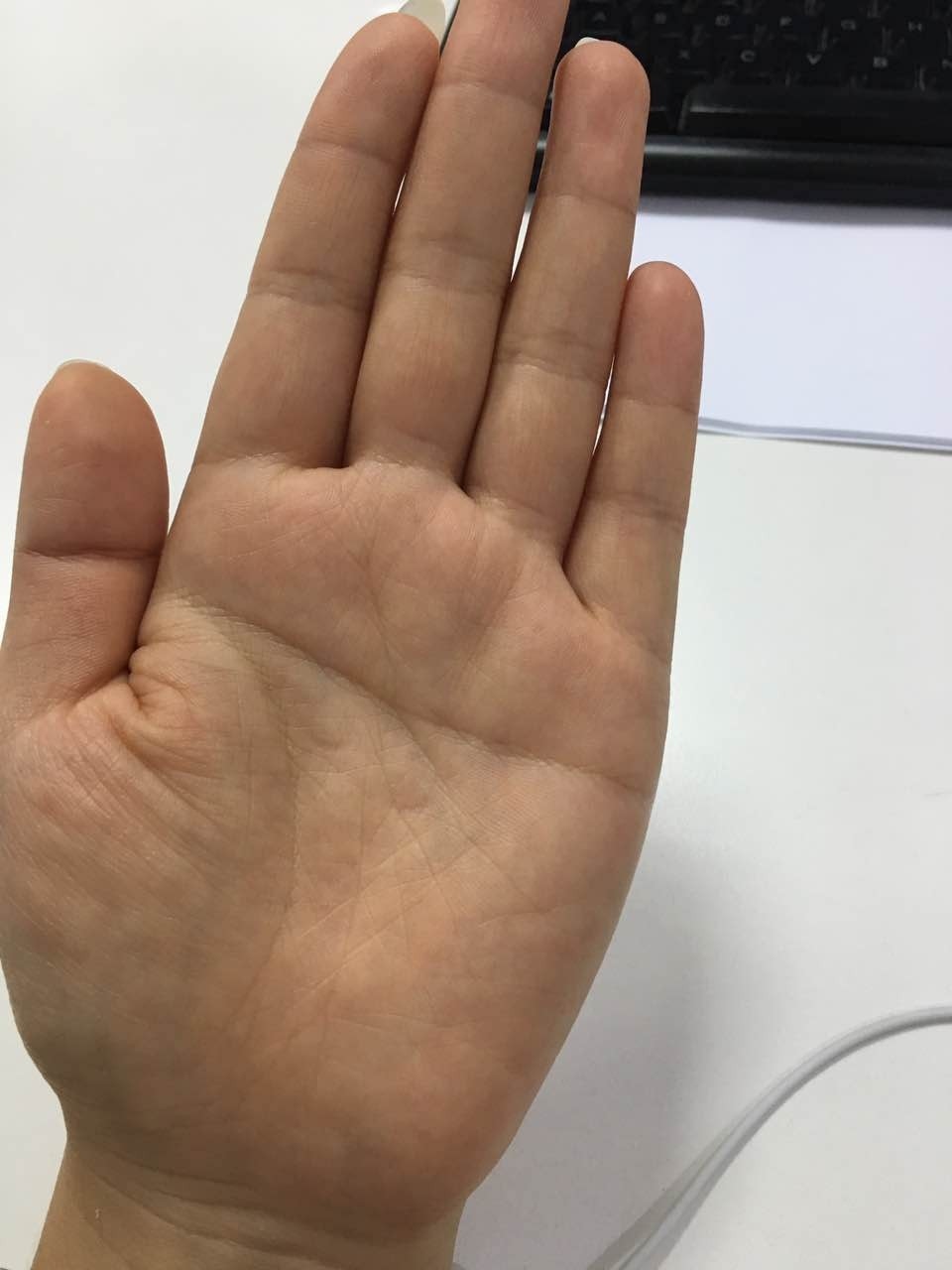 手掌上有痣代表什么含义？手心有意味着的是啥？