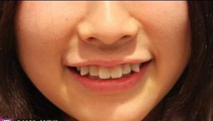 虎牙不能早衰而平的面相有什么特点？虎牙即犬齿
