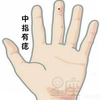 女人右手中指有痣代表什么含义？女人必看！！