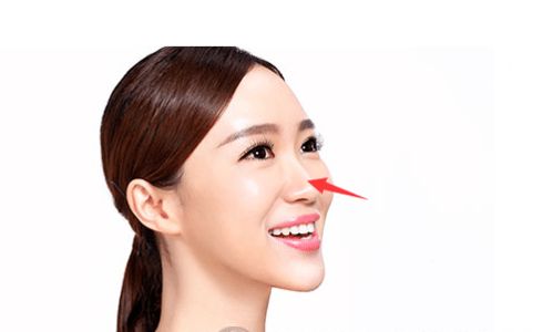 （李向东）女人鼻子的不同部位长痣代表什么