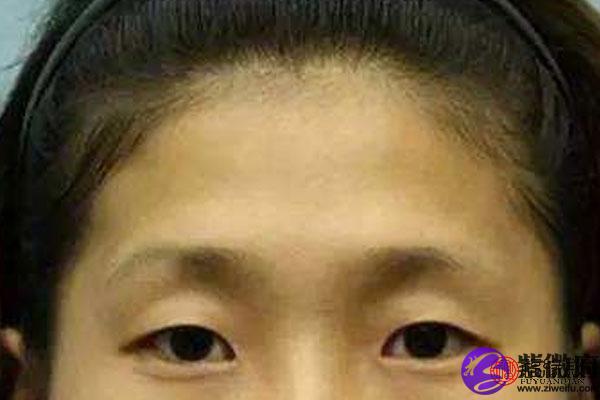 女人眼睛凹陷的面相，你知道几个？