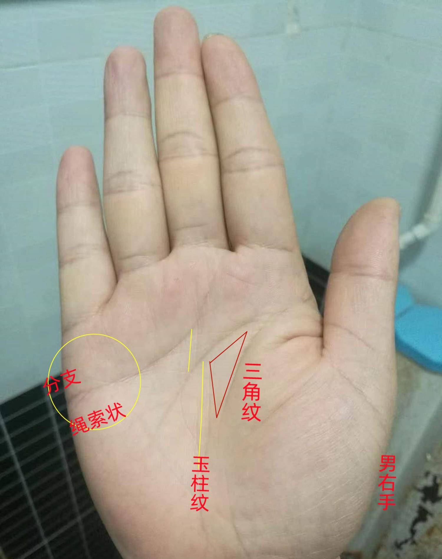 掌纹作为人体的第2张脸，能看出人的多种疾病