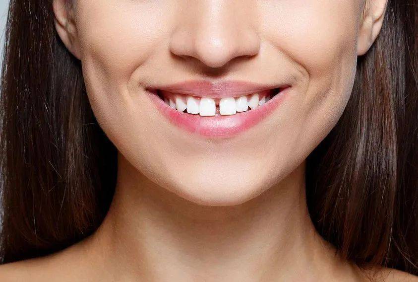 女人如果牙齿不整齐好吗？看看你有没有？