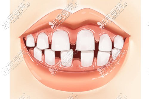 女人如果牙齿不整齐好吗？看看你有没有？
